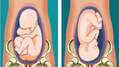 اعراض الولادة المبكرة