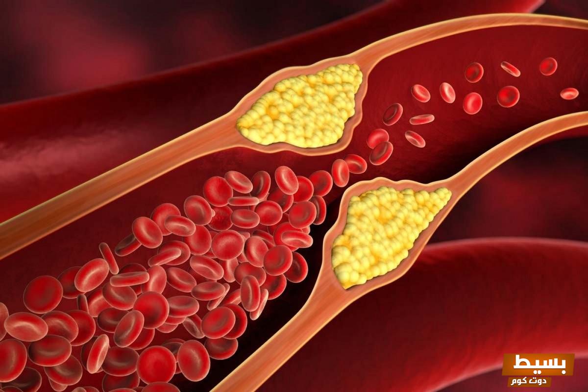 علاج ينزل الكولسترول 2025 اكتشف الحلول الفعّالة لتحسين صحتك والحفاظ على قلبك!