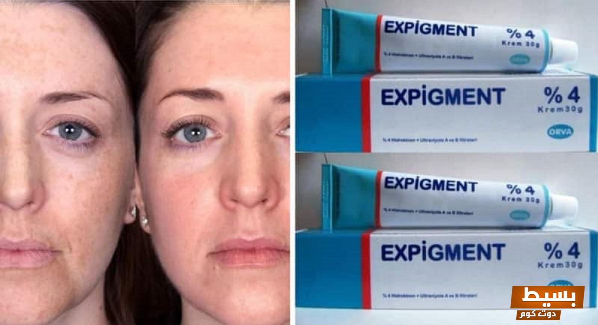 لماذا يستخدم expigment اكتشف السر وراء فعاليته في تفتيح البشرة وتحسين مظهرها!